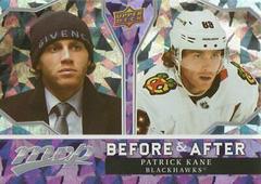 Patrick Kane Hockey Cards 2021 Upper Deck MVP Before and After Prices