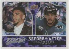 Evander Kane Hockey Cards 2021 Upper Deck MVP Before and After Prices