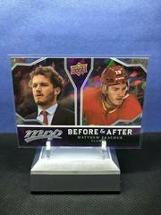 Matthew Tkachuk Hockey Cards 2021 Upper Deck MVP Before and After Prices