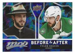Tyler Seguin Hockey Cards 2021 Upper Deck MVP Before and After Prices
