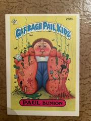 PAUL Bunion #281b 1987 Garbage Pail Kids Prices