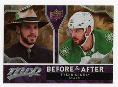 Tyler Seguin [Gold] #BA-3 Hockey Cards 2021 Upper Deck MVP Before and After Prices