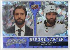 Aaron Ekblad Hockey Cards 2021 Upper Deck MVP Before and After Prices