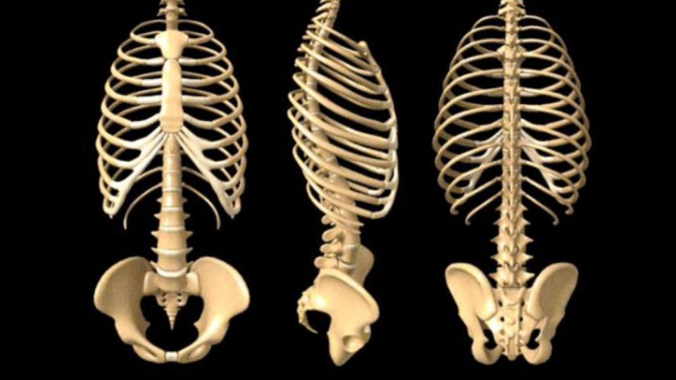 Arch Curl: Lateral Ribs & Crest of Pelvis