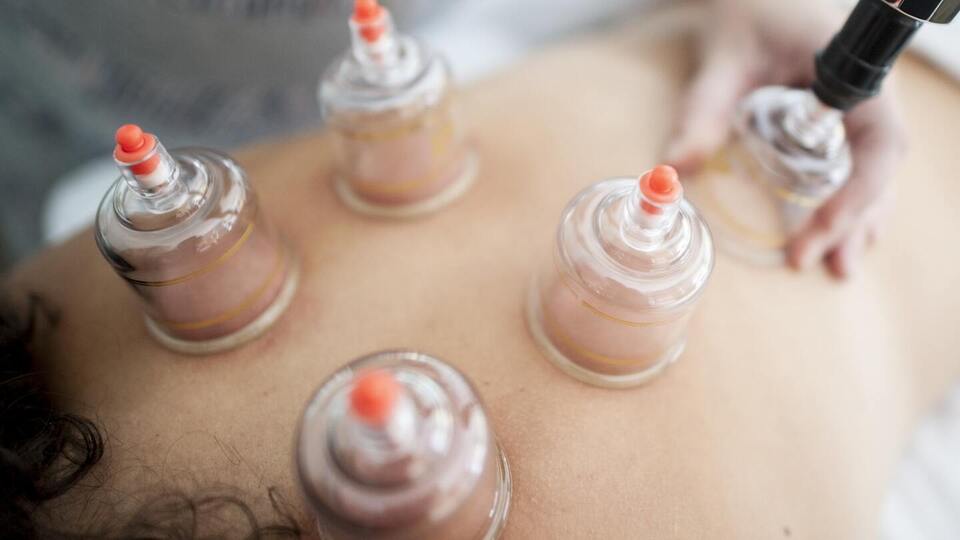 Standalone Cupping = 30 Minutes