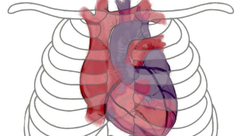 Mini-Mapping: Heart